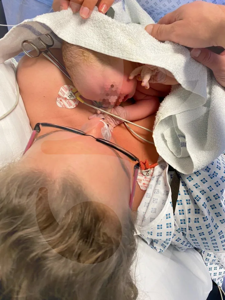 Bea's positive emergency caesarean